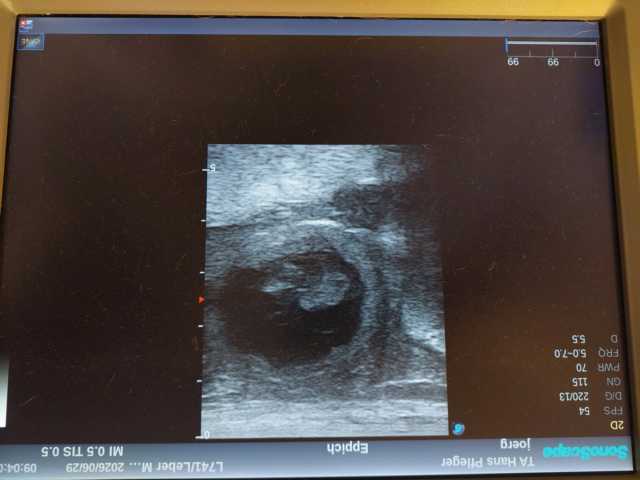 Ultraschall 29.6.26